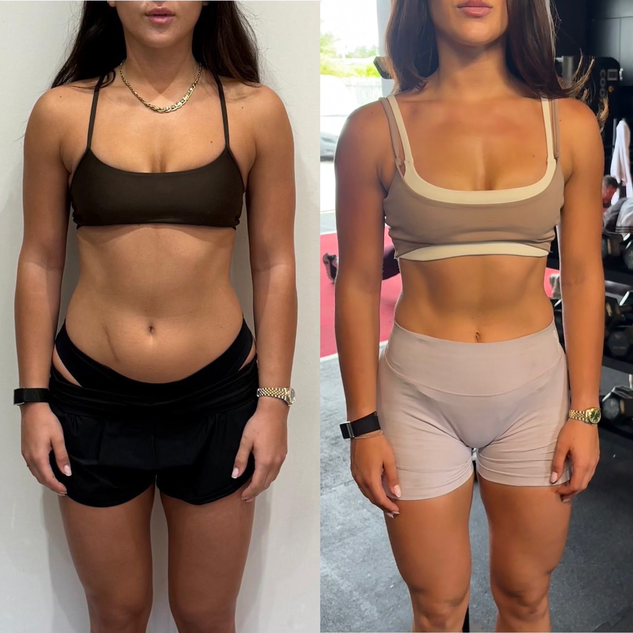 Female client before and after transformation showing visible stomach definition